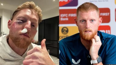 आंख पर सूजन और नाक से बहता खून, इंग्लैंड के कप्तान ने फोटो शेयर की